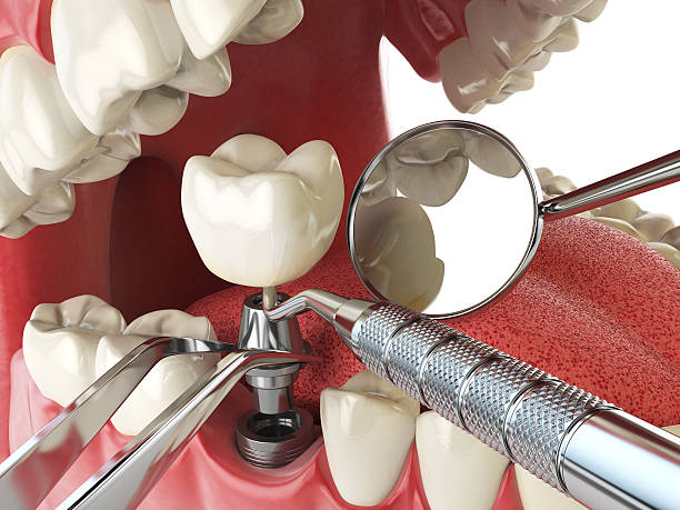 Best Dentist Open Late Near Me  in Mclean, VA